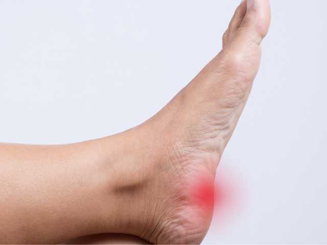 Plantar Fasciitis Pain is located on the medial part of the heel